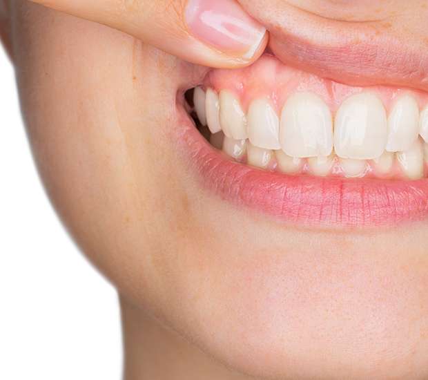 Sherman Oaks Gum Disease