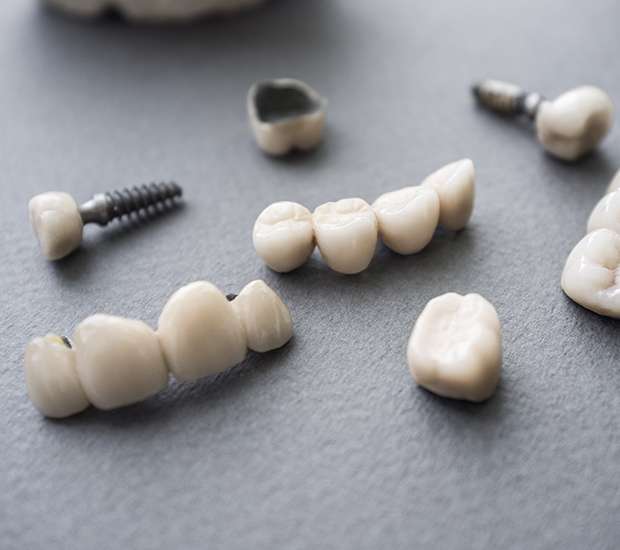 Sherman Oaks The Difference Between Dental Implants and Mini Dental Implants