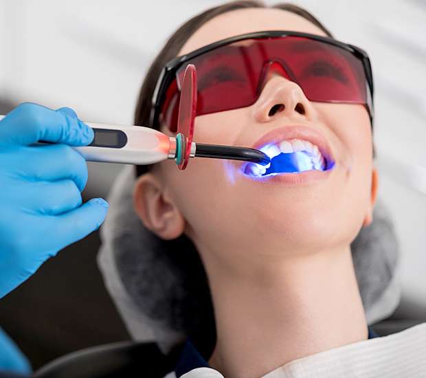 Sherman Oaks Professional Teeth Whitening